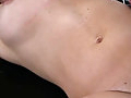 kink